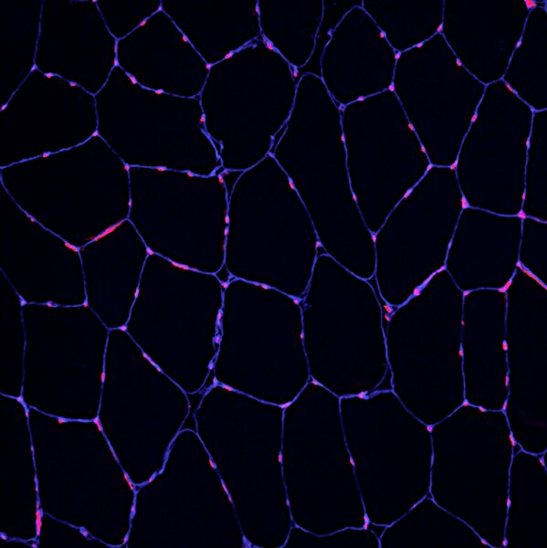 Fluorescent microscope image of a human muscle biopsy cryosection labeled with DSHB antibody D18 (blue). PMID: 33343388, Fig. 1C.